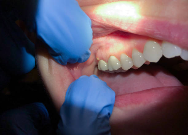  Bonnetsville, NC Emergency Dentist Pros