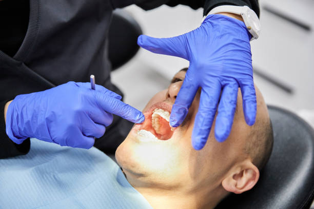 Best Emergency Tooth Extraction in Bonnetsville, NC